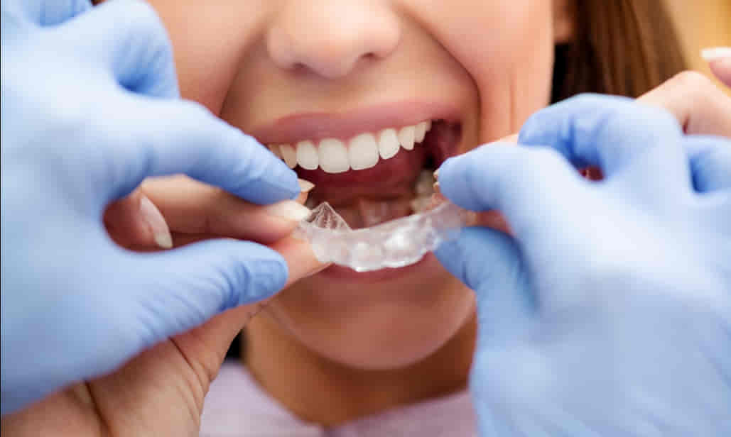 Ottawa pediatric dentist