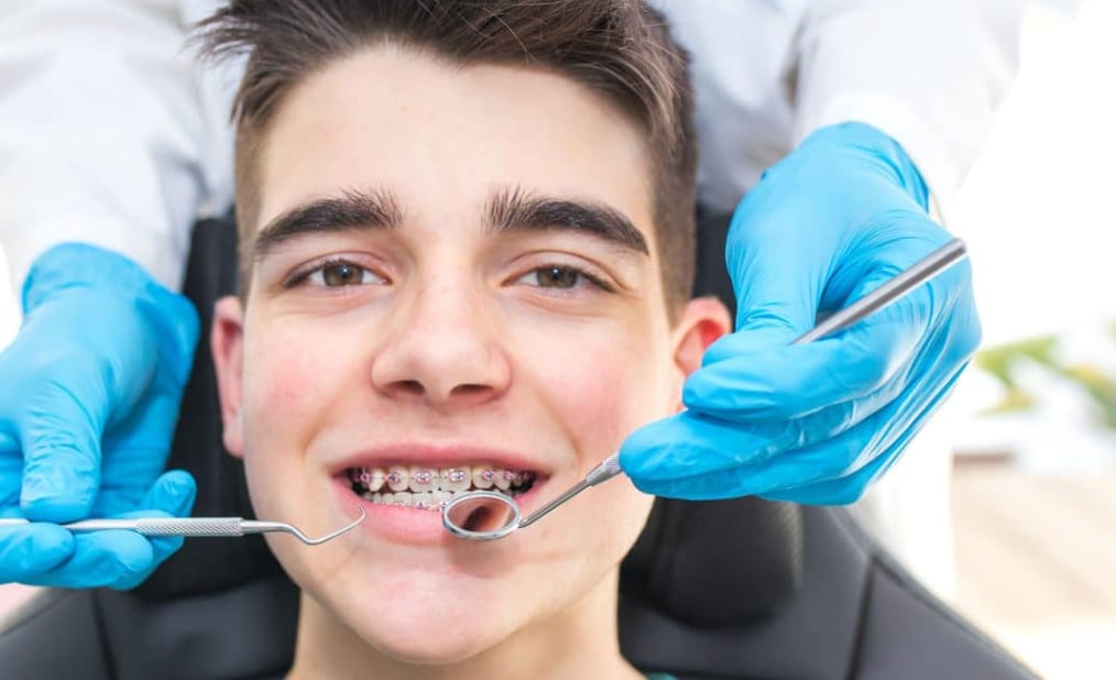 Orthodontic Treatment