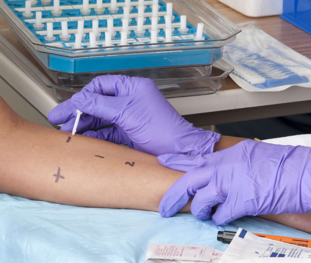 penicillin allergy de labelling