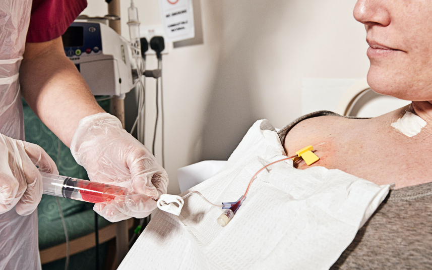 port a cath chemotherapy