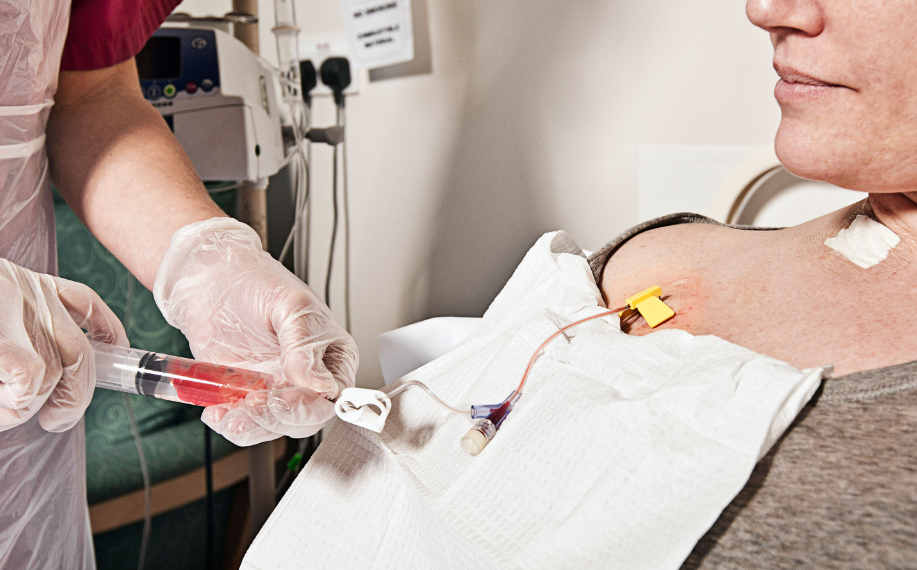 Chemo port insertion