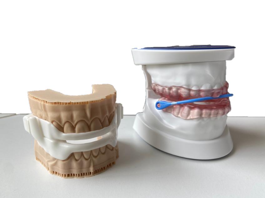 dental appliance for sleep apnea