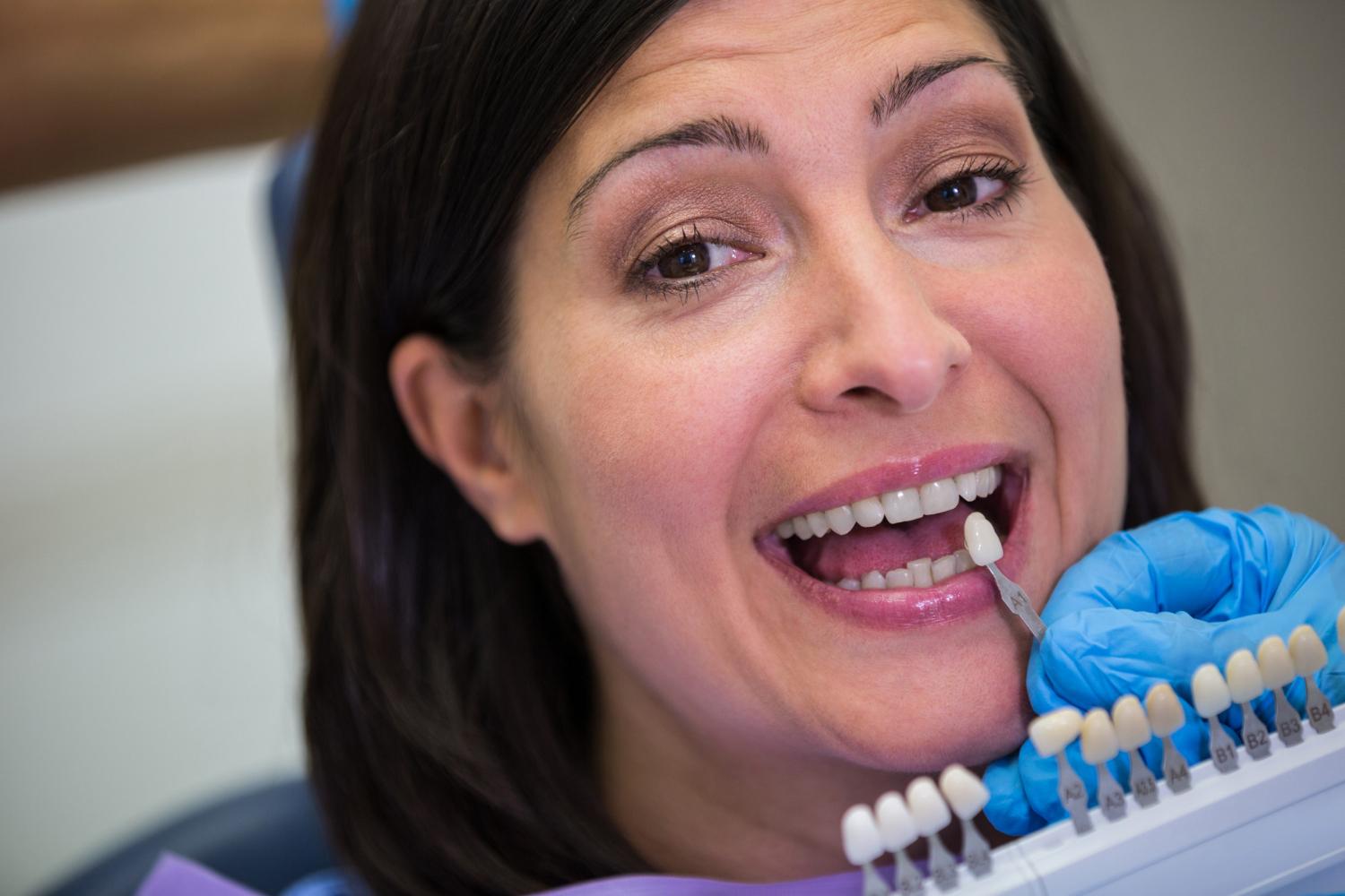 dental tooth implant