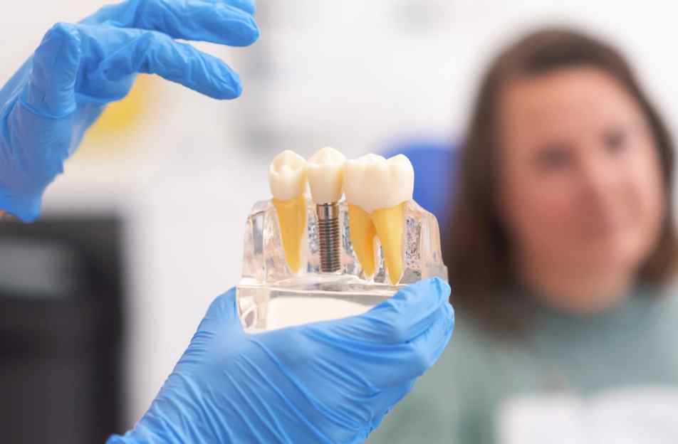 Hughson Dental Implants